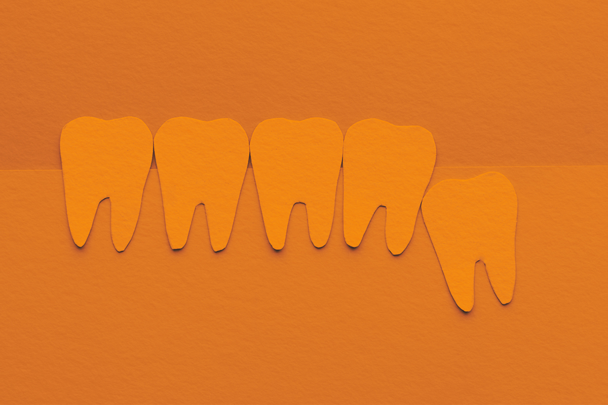 Impacted wisdom teeth cartoon on paper